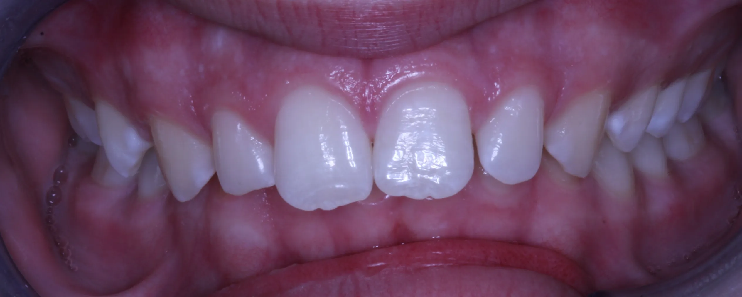 smile-gallery gallery